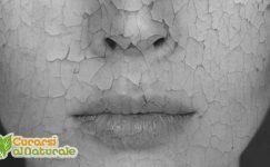 pelle secca viso