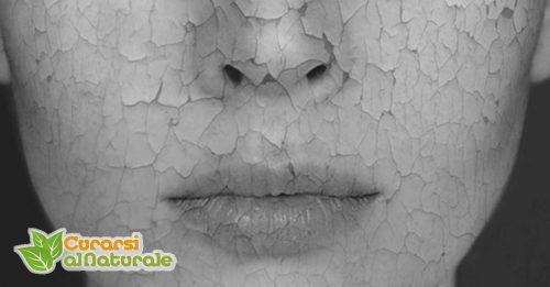 pelle secca viso