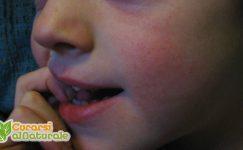 malato di influenza 2016