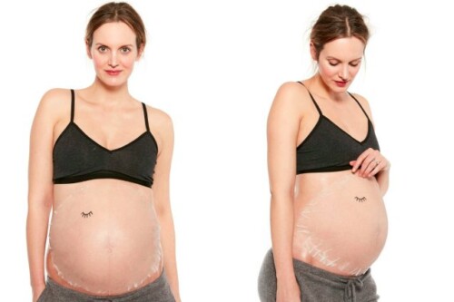 migliori creme per smagliature gravidanza