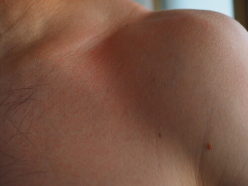 dermatologo online