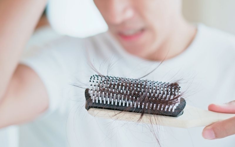 Calvizie psicogena per ansia caduta capelli da stress