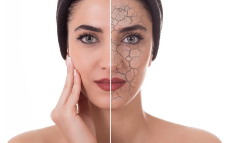 come ingrassare il viso come rimpolpare il viso