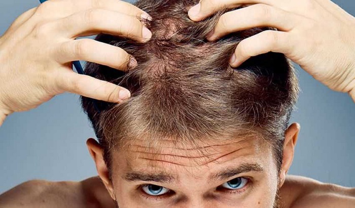 Come rinforzare i capelli di un uomo