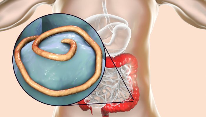 parassiti intestinali